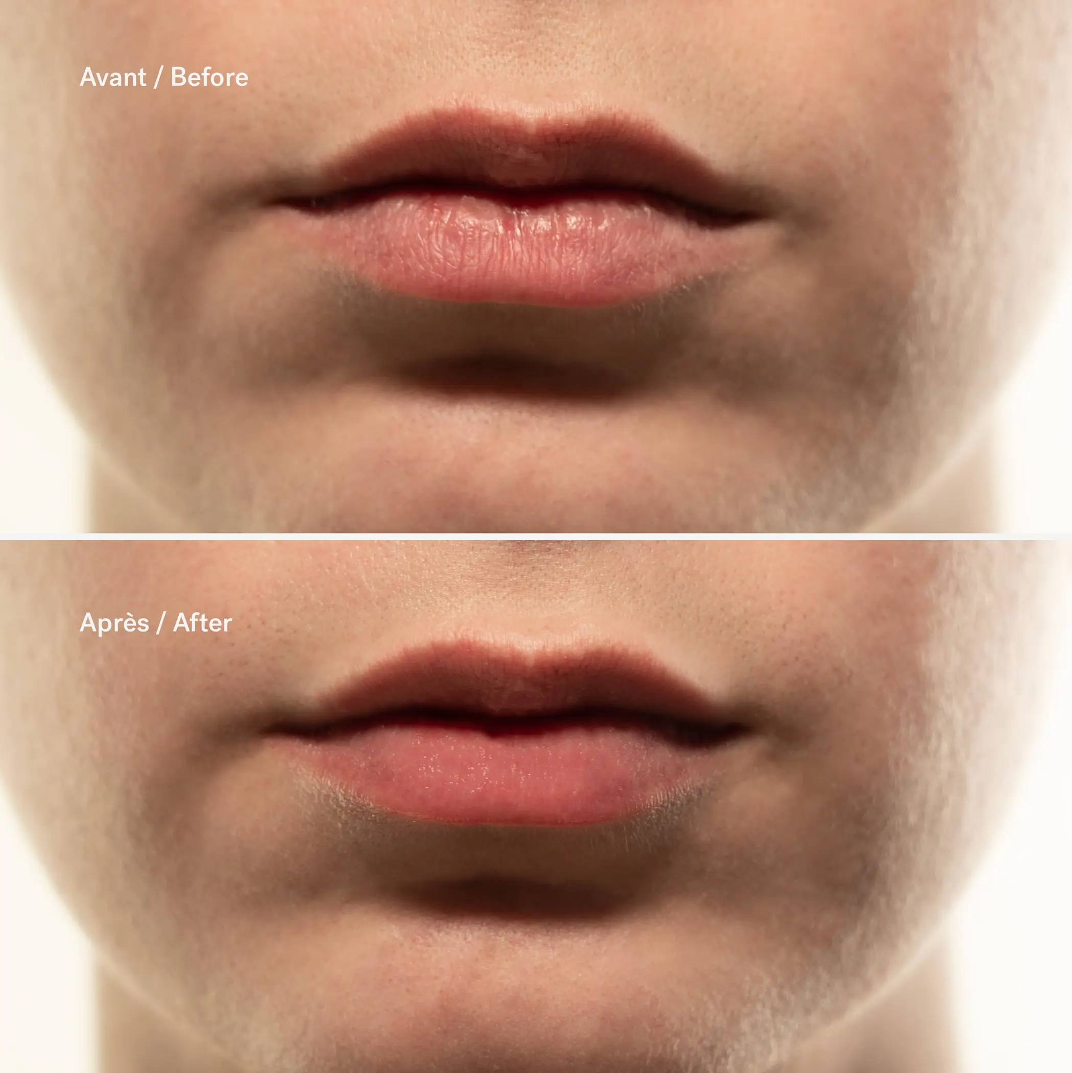 Exfoliating Lip Serum — 2% Mandelic Acid + Pomegranate Enzyme